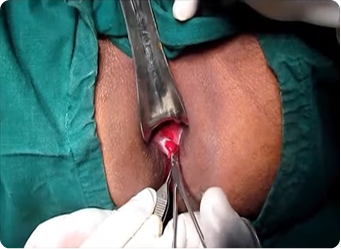 Surgery 1