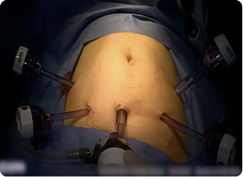 Surgery 2
